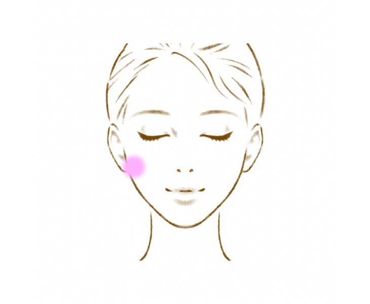 刈谷市で顎関節症・顔のエラの張りに対して施術をしている画像。