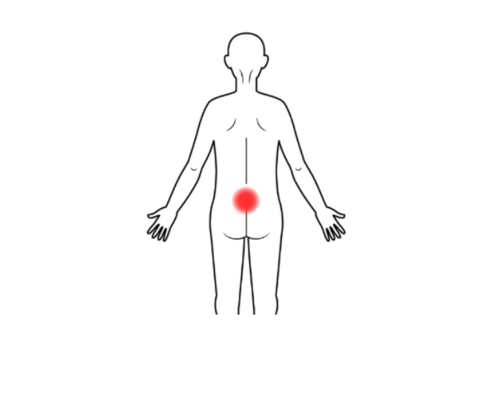刈谷市で腰の背骨沿いに痛みがでる説明をしている画像。