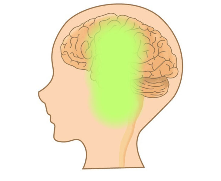 刈谷市で頭痛による側頭部の痛みについて説明している画像。