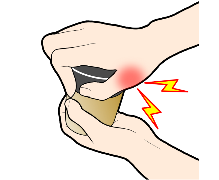 刈谷市で母指の痛みについて説明している画像。