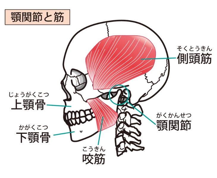 刈谷市で顎関節症の筋肉の痛みについて説明しいてる画像。